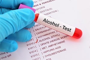 Drug and Alcohol Testing in Domestic Relations Court